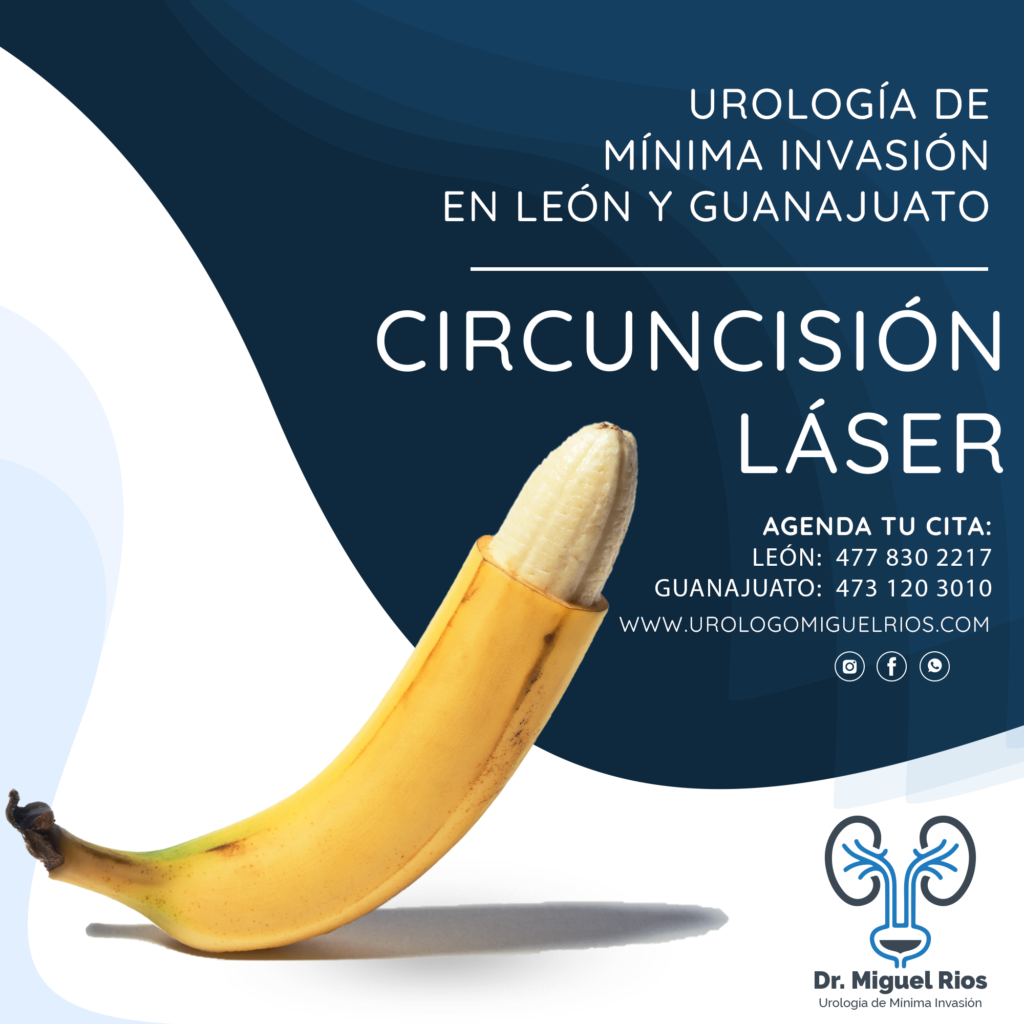 Circuncisión en León guanajuato
