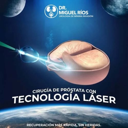 HOLEP Laser Leon Prostata